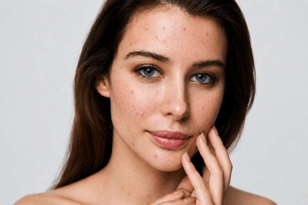 Before beauty retouching showing the original portrait before professional skin retouching and color correction by ClippingBeast.